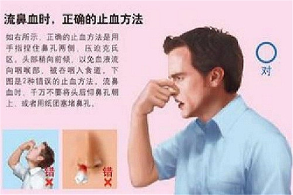 鼻卫士鼻腔康复加盟